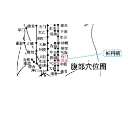 慢性附件炎理療儀