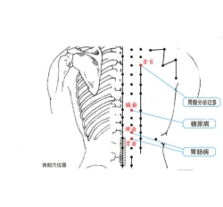 慢性腸炎理療儀