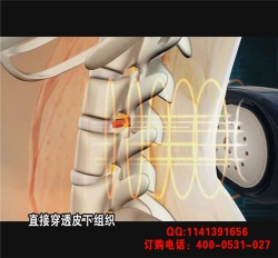 骨刺、骨質增生理療儀