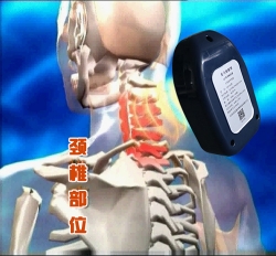 龍馬熨灸器（頸椎部位）