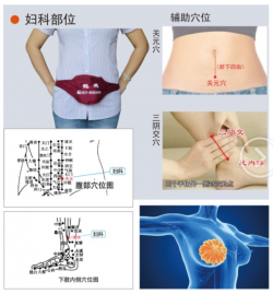 龍馬痛經、閉經理療儀