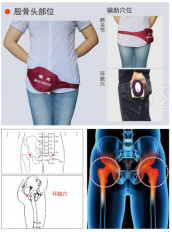股骨頭壞死理療儀