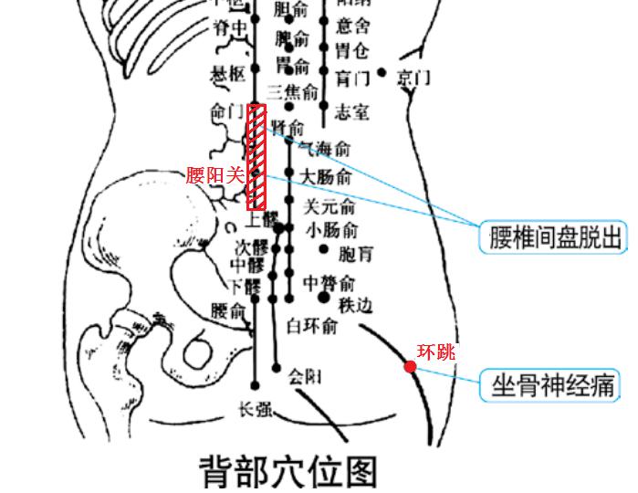 腰椎治療儀
