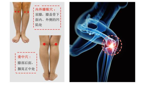 膝關節治療儀