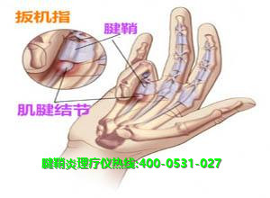 龍馬腱鞘炎理療儀 龍馬腱鞘炎理療儀