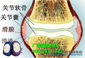 龍馬滑膜炎治療儀 龍馬滑膜炎治療儀
