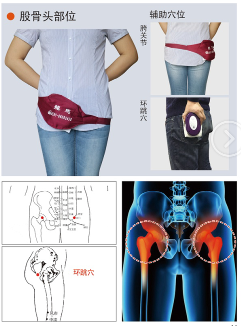 股骨頭.png