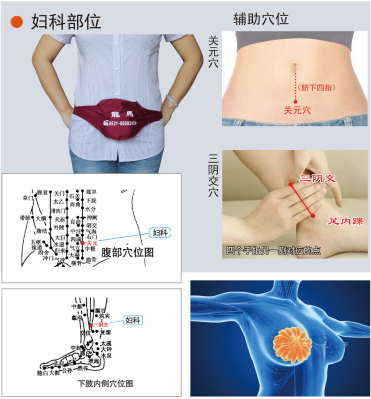 婦科龍馬治療儀
